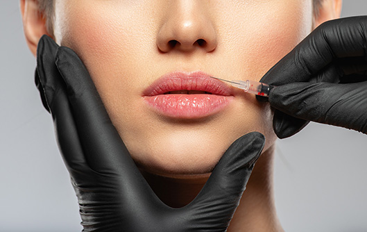 Dermal Filler - A Miracle Aesthetic